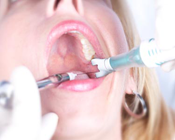 DentalVibe painless injections